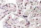 CREB3L2 Antibody (N-Term)